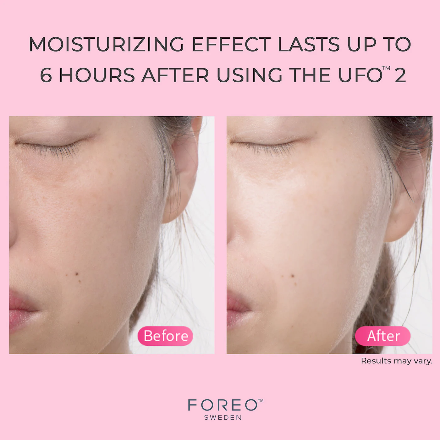 FOREO UFO™ 2 - Image 6